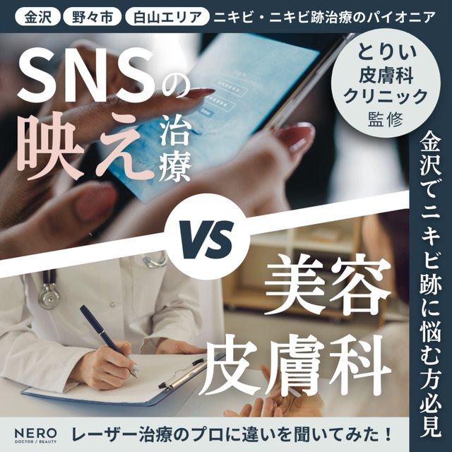 地方クリニックのタイアップ記事(金沢・ニキビ跡治療)